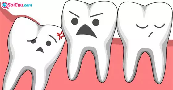 Giải mã giấc mơ thấy răng bị mẻ