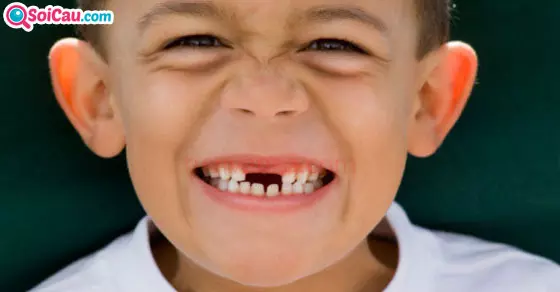 Giải mã giấc mơ rụng răng