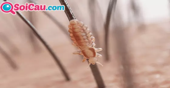 Ý nghĩa giấc mơ thấy con chấy