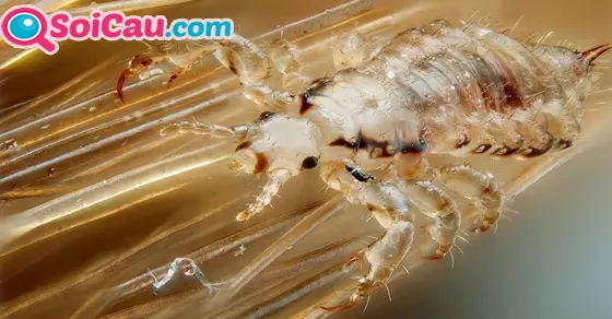 ngủ mơ thấy con chấy đánh đề con gì?