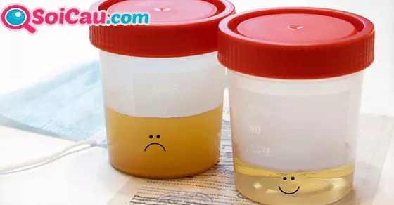 Giải mã giấc mơ thấy nước tiểu