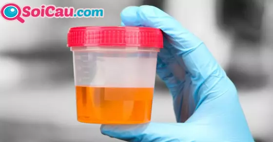 ngủ mơ thấy nước tiểu đánh số mấy?