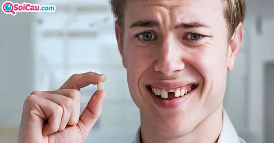 Ngủ mơ rụng răng đánh số mấy?