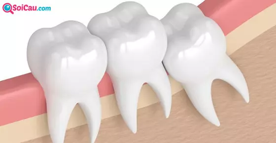 nằm mơ thấy răng đánh con gì?