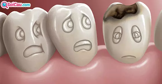 Giải mã giấc mơ thấy răng